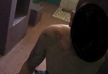 Избиение заключенных в Одесском СИЗО: в сети появились фото побоев